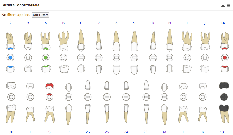 odontogram