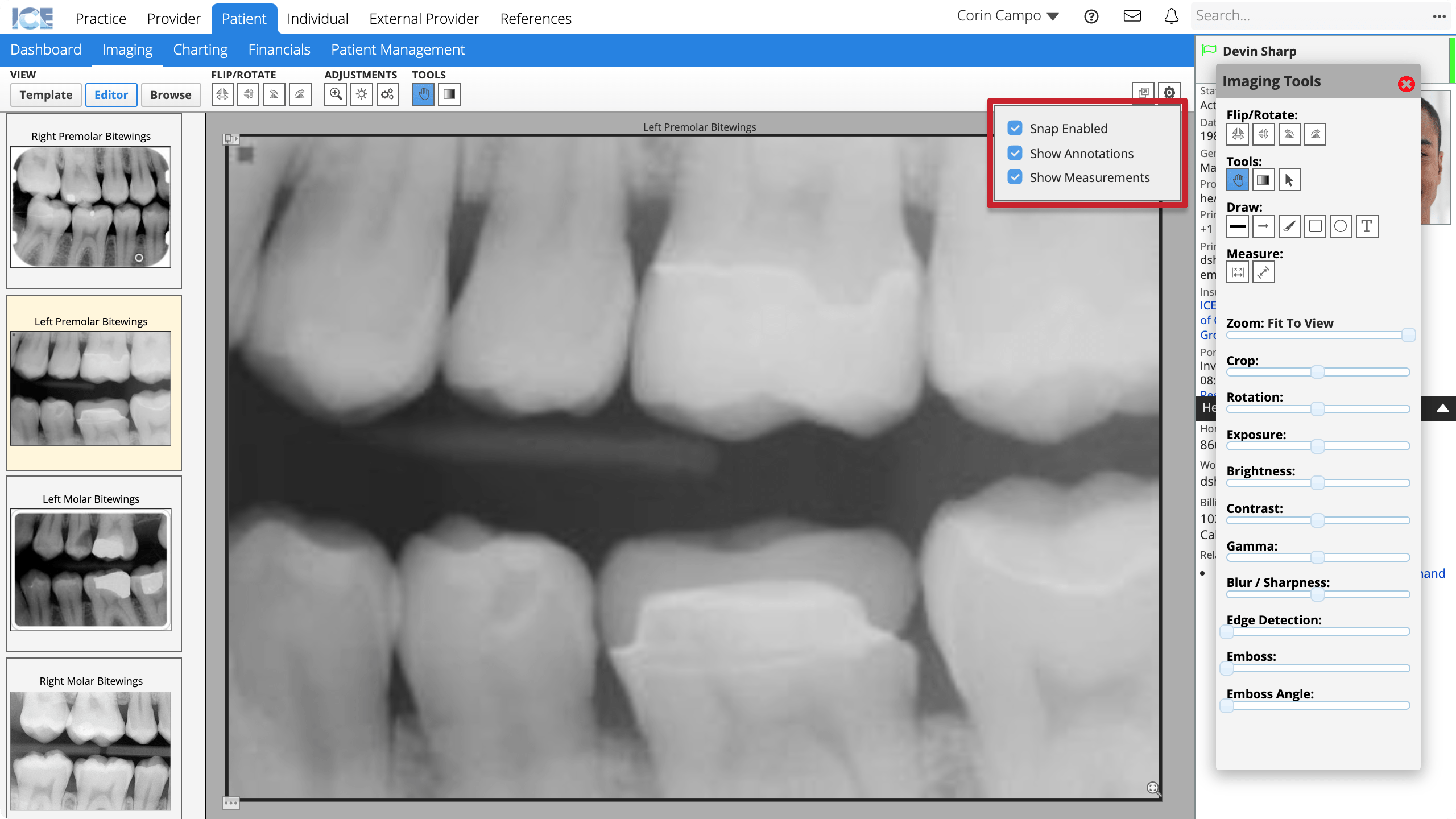 Select the top-right of workspace gear icon to see a drop-down with checkboxes for Snap Enabled, Show Annotations, and Show Measurements.